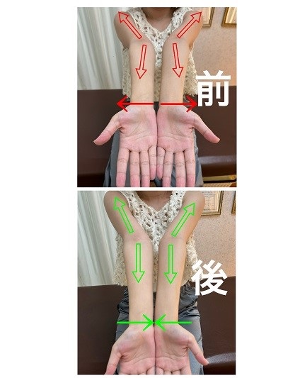 指のシビレ　整体の写真です