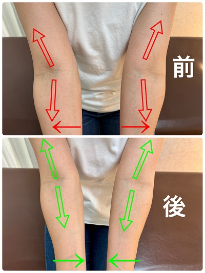 肘　腕　姿勢の写真です
