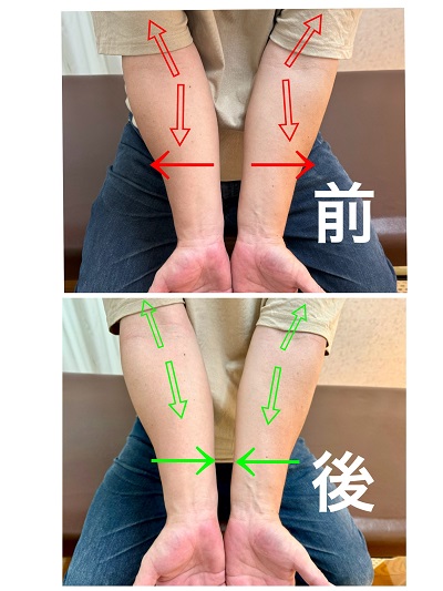 腕　不良姿勢　前後の写真です