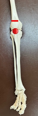 香川県丸亀ふじわら接骨院・整体院 ジャンパー膝の痛む部位です